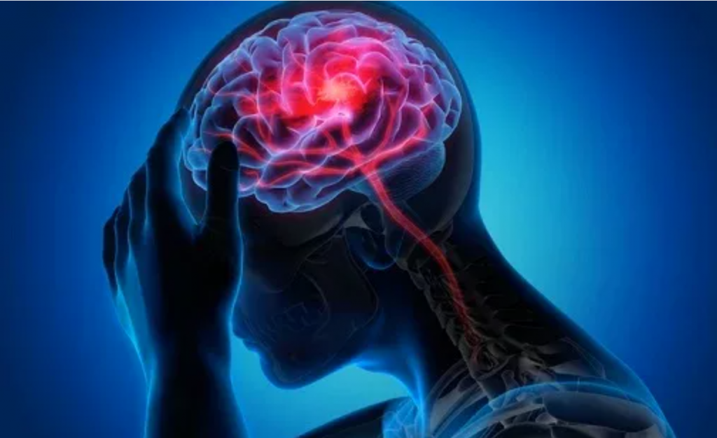 Buone notizie per chi soffre di emicranie croniche. L’anticorpo fremanezumab fa ben sperare: dimezzati gli episodi mensili per chi lo assume regolarmente.